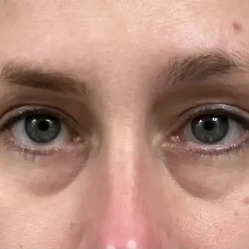 Фото отзыва